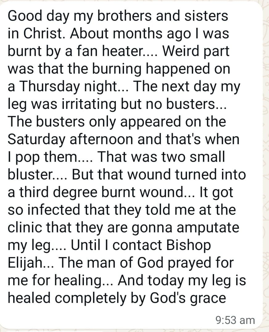 Written testimony of a burn healed through prayer