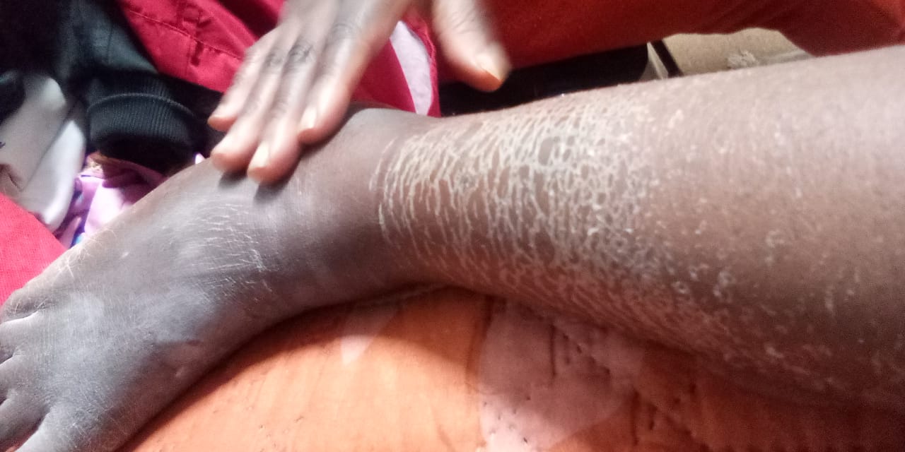 Leg healing testimony photo shared by a church member